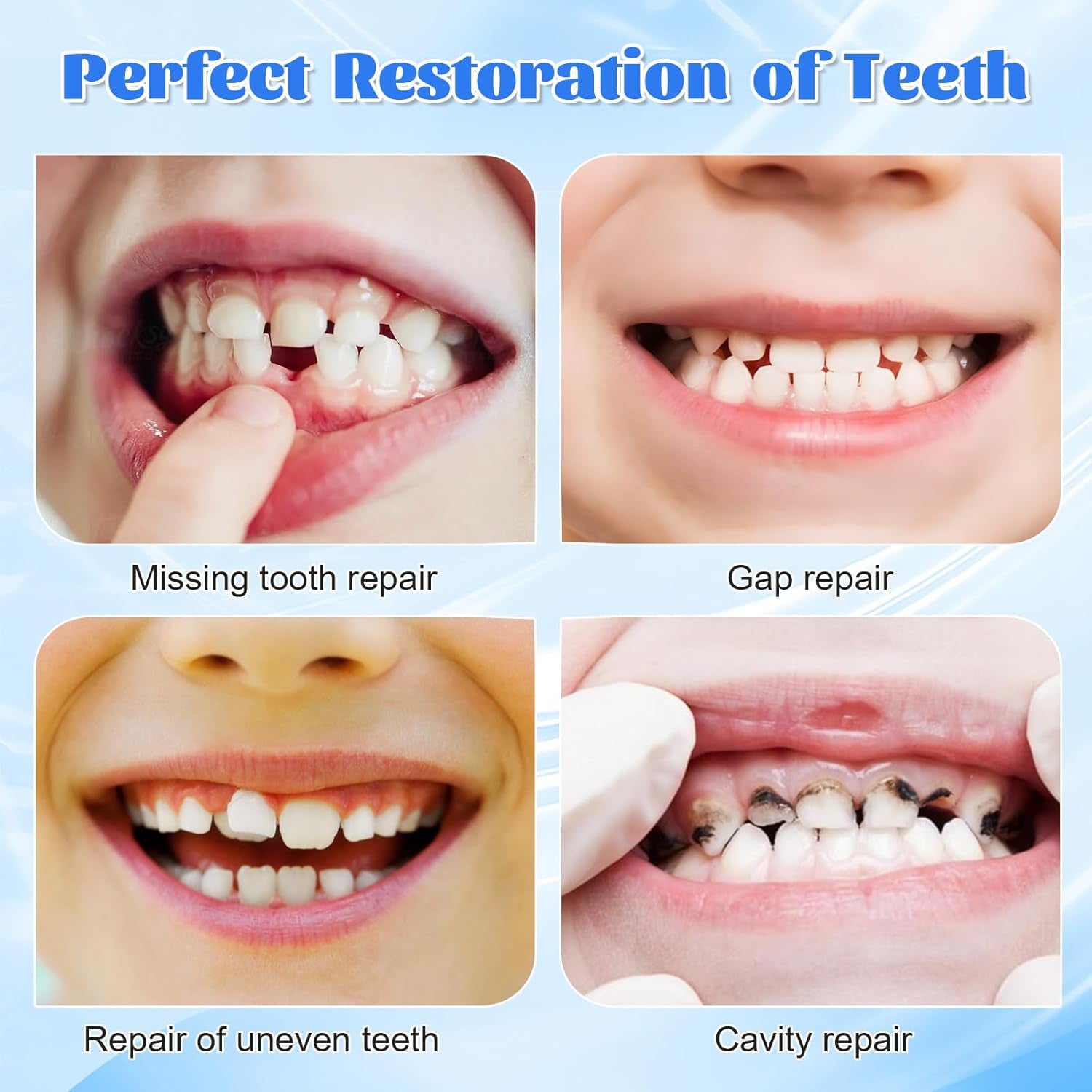 Provisorische Zahnfüllung Reparatur-Kit, Zahnersatz Selber Machen, 30ML Zahnfüllung Zahnzement, Zahnreparatur Perlen, Zahnreparatur-Kit Für Reparieren Fehlender Gebrochener Und Großer Zahnlücken