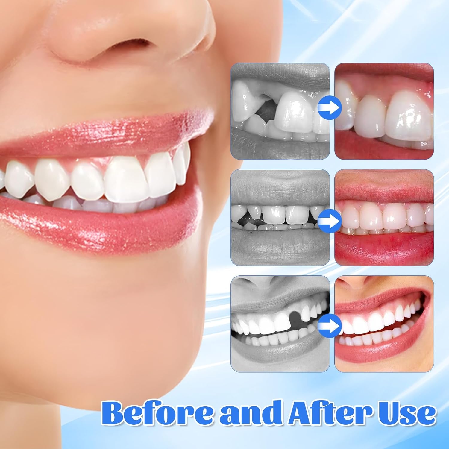 Provisorische Zahnfüllung Reparatur-Kit, Zahnersatz Selber Machen, 30ML Zahnfüllung Zahnzement, Zahnreparatur Perlen, Zahnreparatur-Kit Für Reparieren Fehlender Gebrochener Und Großer Zahnlücken