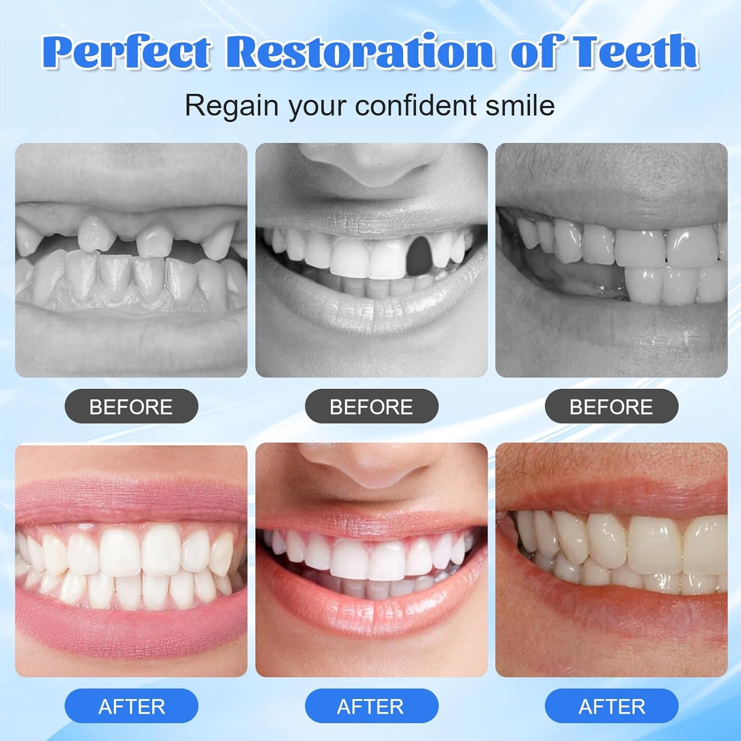 Provisorische Zahnfüllung Reparatur-Kit, Zahnersatz Selber Machen, 30ML Zahnfüllung Zahnzement, Zahnreparatur Perlen, Zahnreparatur-Kit Für Reparieren Fehlender Gebrochener Und Großer Zahnlücken