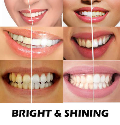 Powerful Ultimate Strength 44% CP Whitening Kit Best Seller on Ebay~Usa